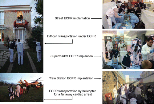 Figure 2. Pre-hospital ECPR.