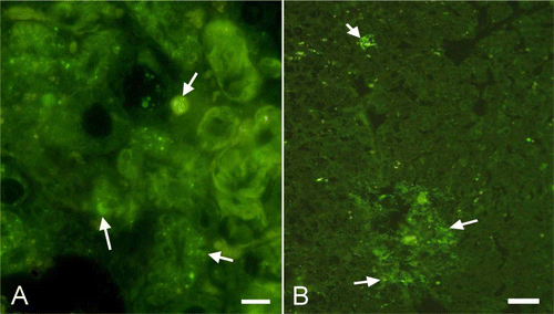 Figure 4.  4A: Immunolabelling of S. Gallinarum in cytoplasm of the tubules in the kidney (arrows, young bird) Immunofluorescence method. Bar = 20 µm. 4B: Immunopositive reactions in the liver (arrows, adult bird). Immunofluorescence method. Bar = 40 µm.
