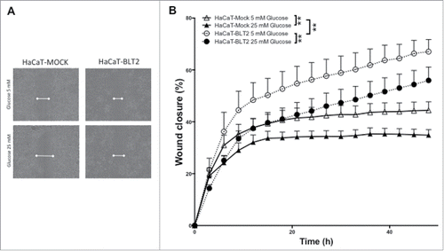 Figure 6. High glucose reduces wound healing capacity, an effect that is attenuated in cells that express BLT2. (A) Representative micrographs of wound healing assays in HaCaT cells, for 48 h under low (5 mM) and high (25 mM) glucose, (B) typical kinetic curve of migration and wound closure. Data represent the mean ± SEM, n = 6 independent experiments **p < 0.01 2-Way ANOVA.