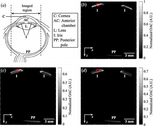 Figure 9. (a) Schematic of the eye. B-scan images across the center of the eye using (b) 465 (c) 750, and (d) 870 nm.