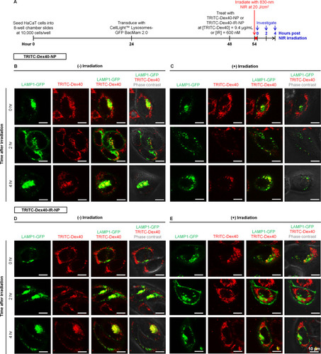 Figure 8 (A) Timeline of the experiments for monitoring endolysosomal escape and deconvoluted confocal microscopy images of the HaCaT keratinocytes at 0, 2, and 4 hours post 6-hour treatment with (B, C) TRITC-Dex40-NP and (D, E) TRITC-Dex40-IR-NP (B, D) without and (C, E) with 830-nm irradiation at fluence of 20 J/cm2. Scale bar = 10 µm.