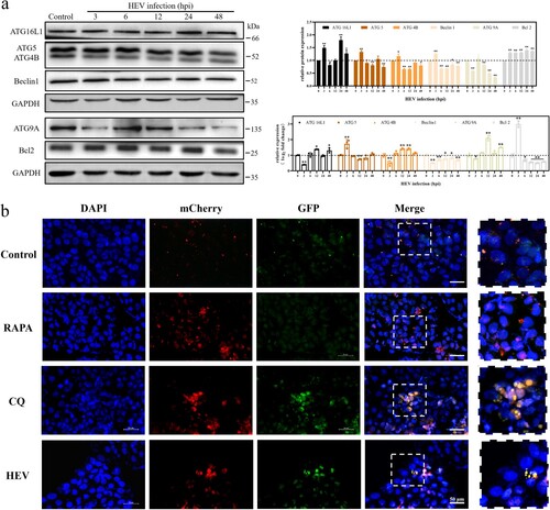 Figure 4. Autophagy flux inhibition in JEG-3 cells with HEV genotype 3 infection. (a) Western blot of ATG16L1, ATG5, ATG4B, Beclin1, ATG9A, and Bcl2 protein in JEG-3 cells with different time HEV infection. Bars indicate mean ± SEM, n = 3. *P < .05, **P < .01 (b) Fluorescence photos of JEG-3 cells transfected with mCherry-GFP-LC3 plasmid treated with PBS, RAPA (100 nM), CQ (50 μM) and HEV. Nuclei stained by DAPI. Scale bar represents 50 μm.