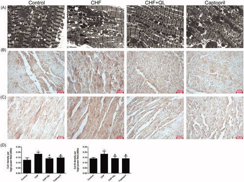 Figure 2. QL improved myocardium ultrastructure and reduced fibrosis. (A) TEM images of left ventricles of rats. (B, C) IHC disclosed that QL markedly downregulated collagens I and III. (D) Collagens I and III positive integral optical density. *p < 0.05, **p < 0.01 vs. control group. #p < 0.05, ##p < 0.01 vs. CHF group.