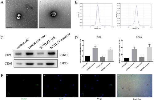 Figure 2. Identification and uptake of adipocyte-derived exosomes. (A) Typical images of microscopic morphology of exosomes under transmission electron microscope (left: control group; right: WSTLZT group), scale bar = 200 nm. (B) Detection of the diameter distribution of adipocyte-derived exosomes (left: control group; right: WSTLZT group). (C) The protein levels of CD9 and CD63 in 3T3-L1 cells and exosomes secreted by cells were measured by western blot. (D) Relative protein expression of CD9 and CD63 was analysed to those in control. (E) Fluorescence microscope images of colocalization of exosomes from cells 3T3-L1 cells with BMSC. Exosomes were labelled by PKH-67 (green) and cell nuclei were stained with DAPI (blue), scale bar = 100 μm. Mean ± SEM (n = 3), **p < 0.01 vs. control-cell group.