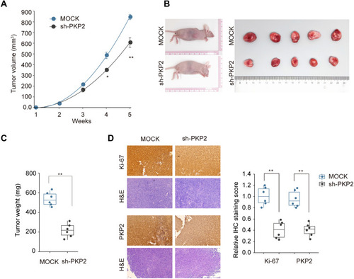Figure 5 Knockdown of PKP2 inhibits xenograft lung tumor development in vivo. A549 cells were stably transfected with sh-PKP2 or MOCK, and then subcutaneously injected into nude mice. (A and B) The tumor growth was monitored for 5 weeks and xenograft tumors from different groups were photographed after dissecting the tumor at the end of experiment. (C) Tumor weights were analyzed. (D) IHC staining was performed to examine the Ki-67 and PKP2 expression in tumor tissue sections. *P < 0.05, **P < 0.01.