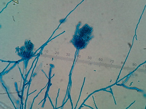 FIGURE 1.  Lactophenol cotton blue mount showing filamentous fungi with biseriate phialides covering upper surface of the vesicle typical of Aspergillus terreus. Magnification × 400 863 × 647 mm (96 × 96 DPI).