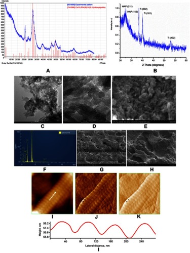 Figure 2 XRD pattern for ms-HAP/COL lyophilized powder (A) and for HAPc composite (ie, ms-HAP/COL@PLA/COL) coating on Ti surface (B); HR-TEM images (C, D) for ms-HAP/COL nanoparticles; SEM image (E) and EDX spectrum for same area (F) for ms-HAP/COL; SEM images (G, H) of the surface of HAPc coating on Ti; AFM images (I–K) of a COL fiber self-assembled in the COL layer of HAPc coating on Ti: 2D-topography (I), phase image (J) and amplitude image (K), for scanned area of 1 μm×1 μm; cross-section profile (L) on the white arrow in (I).Abbreviations: XRD = X-ray diffraction; ms-HAP/COL = multisubstituted hydroxyapatite/collagen; ms-HAP/COL@PLA/COL = multisubstituted hydroxyapatite/collagen and poly-lactic acid/collagen; Ti = titanium; HAPc = titanium implant coated with multisubstituted hydroxyapatite and collagen; HR-TEM = high resolution transmission electron microscope; SEM = scanning electron microscope; EDX = energy-dispersive X-ray spectometer; AFM = atomic force microscope; COL = collagen.