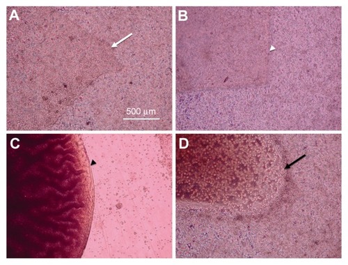 Figure 1 Micrograph of cultured HeLa cells under the different conditions. (A) HeLa cells covered over the hyperdry human amniotic membrane (white arrow), (B) freeze-dried human amniotic membrane (white arrow head), and (D) collagen gel (black arrow). (C) There were no HeLa cells near the 2-octyl-cyanoacrylate (black arrow head).