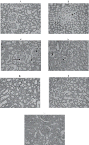 Figure 2. Histopathology of kidney using hematoxylin and eosin (A–G; H&E × 20). Control rats showed normal glomeruli and tubules (Figure 2A). Figures 2B–2E represent kidney section of high-fructose-fed rats. Figure 2B shows tubules having fatty infiltration. Figure 2C shows segmented glomerulo nephritis, with the tubules showing fat accumulation. Figure 2D shows hyaline casts in tubules. Figure 2E shows fatty infiltration in parenchyma cells, and Figure 2F represents the kidney section of fructose-fed rats treated with genistein, showing cloudy swelling and mild fat accumulation in tubules. Figure 2G represents the kidney section of normal rats treated with genistein in which the glomeruli show mild congestion.