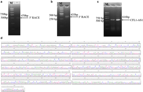 Figure 2. Cloning of long non-coding RNA CFL1-AS1. (a) the PCR product of 5‘RACE second-round amplification. (b) the PCR product of 3‘RACE second-round amplification. (c) the PCR product of full-length CFL1-AS1 sequence. (d) Peak plot of full-length CFL1-AS1 sequencing.