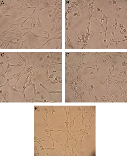 Figure 5.  The results of removing test compounds from the pre-incubated medium of PC 12 cells prior to the injury initiated by H2O2. (A) PC 12 control cells. (B) PC 12 cells exposed to 600 μM H2O2 for 3 h. Most of the cells become round shapes. The membrane lesion of cells was also observed. (C, D and E) PC 12 cells were pre-incubated with 20 μg/mL of compounds 4, 13 and quercetin, respectively, and then the compounds were removed from the medium and the cells were exposed to 600 μM H2O2 for 3 h. The cells cultured with compounds 4 and 13 were remarkably improved in cell viabilities and integralities.