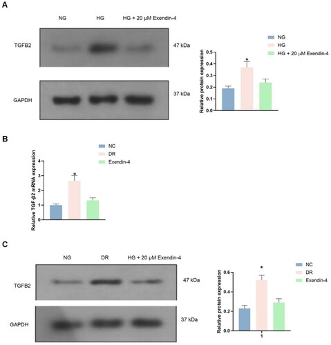 Figure 3. Exendin-4 is involves in the TGFB2 expression regulation. (A) The protein expression level of TGFB2 in HRECs was detected using western blotting. (B) and (C) The expression of TGFB2 in the rat peripheral blood and retinae was evaluated using qRT-PCR and western blotting. n = 5, comparison with NC,* P < 0.05.