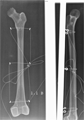 Figure 3. Radiographs of the femur showing anterior-posterior and lateral views.