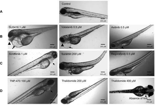 Figure 4 Gross morphological changes in the zebrafish larvae following anti-angiogenic compound exposure at 96 hours.