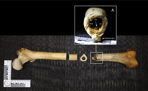 Figure 4. Left femur, anterior view. Inset A: distal kerf wall; arrows indicate direction of blade progress. Note: the midshaft transections are associated with sampling for histological analyses in 1979 and 2019.