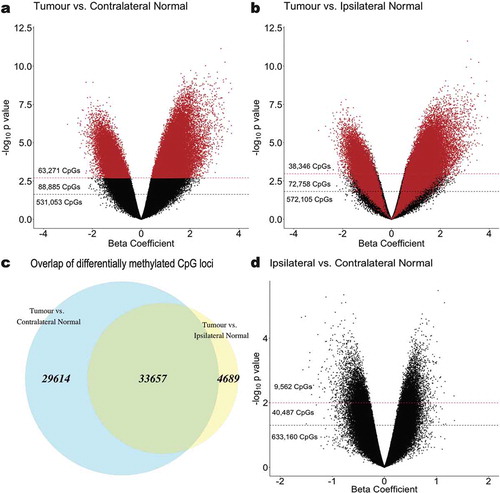 Figure 2. Epigenome-wide association analyses identifying CpG sites that are significantly differentially methylated in (a) tumour relative to contralateral-normal tissue and (b) tumour relative to ipsilateral-normal tissue. The beta coefficient reflects the difference in M-value associated with tissue type, adjusted for subject age and parity. Red dashed lines indicate a significance threshold of q < 0.01 and black dashed lines indicate a significance threshold of q < 0.05. CpGs are coloured (red) by sites identified as significant in the tumour versus contralateral-normal tissue (q < 0.01) analysis. (c) Overlap (green) between significantly differentially methylated CpG loci (q < 0.01) in tumour versus contralateral-normal and tumour versus ipsilateral-normal tissue. (d) Epigenome-wide association analysis identifying CpG sites that are significantly differentially methylated in ipsilateral-normal relative to contralateral-normal tissue. Red dashed lines indicate a significance threshold of p < 0.01 and black dashed lines indicate a significance threshold of p < 0.05.