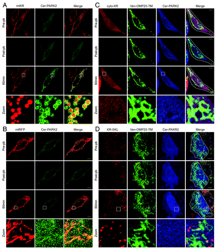 Figure 2. ROS produced only within the mitochondria leads to PARK2 recruitment to the mitochondria. Representative images of HeLa cells that were transfected with mtKR (A) or mtRFP (B) and Cer-PARK2 16 to 24 h prior to the experiments. Cells were irradiated with 561 nm laser for 30 iterations at 100% output. Images were acquired immediately before and after the photo-bleaching. Cells were then imaged live for 60 min, and the 561 nm laser power was increased from 1% to 2% after the photo-bleaching. The magnification of the square box in 60 min is shown in the panels labeled zoom. (C and D) Representative images of HeLa cells co-transfected with cytosol KR (cyto-KR) (C) or peroxisomal KR (KR-SKL) (D), Venus-OMP25-TM and Cer-PARK2 for 16 to 24 h. The white outline shown in the merge panel indicates the region in which the KR was photo-bleached with the 561 nm laser for 30 iterations at 100% output. A pre-pb image and a post-pb image were acquired and the cells were monitored for 60 min after photo-bleaching. The magnification of the square box in 60 min is shown in the panels label Zoom. Scale bar: 10 µm.