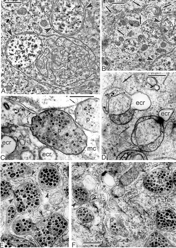 Figure 7. Specific plastids, typical for Magnoliaceae microspores. A, B. Magnolia sieboldii, mid-tetrad microspores: A. Plastids, associated with chain-mail reticulum (cr); plastids contain plentiful osmiophilic globules and they are wrapped in a sheet of endoplasmic reticulum (arrowheads); B. Plastids (two of them are wrapped in an endoplasmic reticulum sheet, arrowheads) and a stack of endoplasmic reticulum cisternae, undulating through the cytoplasm (arrows); compare with the corresponding structure in Liriodendron chinense, Figure 10G. C. Michelia fuscata: Plastids in contact with endoplasmic reticulum cisternae (arrows) contain many osmiophilic globules in their matrix in young free microspore; elements of chain-mail reticulum (ecr) are adjacent. D. Manglietia tenuipes: Cup-like plastids (cp) with osmiophilic globules (shown in side view) in contact with endoplasmic reticulum (arrows) and associated with elements of chain-mail reticulum in late tetrad microspore. E, F. Michelia fuscata: Early free microspores at stage of vacuolisation; plastids with characteristic osmiophilic globules in contact with rough endoplasmic reticulum (arrowheads). Abbreviations: see Figure 1. Scale bars – 1 μm.