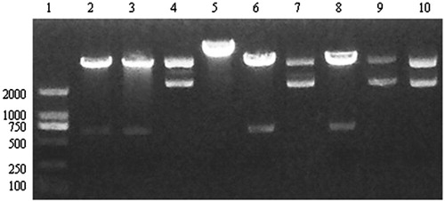 Figure 3. pYr-1.1–CaMKIIγ-shRNA plasmid digest with BASI enzyme. Lane 1. Marker. Lane 2, 3, 4 pYr-CaMKIIγ-shRNA-1 three different bacterial clones. Lane 5, 6, 7 pYr-CaMKIIγ-shRNA-2 three different bacterial clones. Lane 8, 9, 10 pYr- shRNA-CaMKIIγ-3 three different bacterial clones.