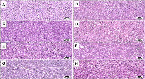 Figure 9 Histopathological images of the liver cells. Liver tissue from the control group showing normal histological structure (A). Liver tissue from the model group showing diffuse steatosis of the hepatic parenchyma (B). Liver tissue from plain-SNEDDS-loaded 3D-P polypills showing steatosis of hepatocytes (C). Liver tissue from non-SNEDDS-loaded GMD 3D-P polypills showing hemorrhages and steatosis of the hepatic parenchyma (D). Liver tissue from non-SNEDDS-loaded RSV 3D-P polypills showing widespread micro and macrovesicular steatosis in the hepatic parenchyma (E). Liver tissue from SNEDDS-loaded GMD 3D-P polypills showing apparently normal hepatocytes (F). Liver tissue from SNEDDS-loaded RSV 3D-P polypills showing mild dilation of hepatic sinusoids (G). Liver tissue from SNEDDS-loaded GMD/RSV 3D-P polypills showing apparently normal hepatic parenchyma (H).