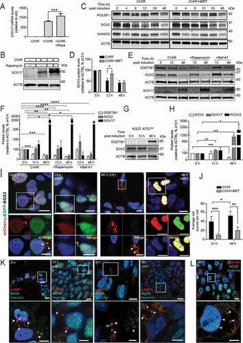 Figure 4. Autophagy modulation affects DE differentiation through SOX2 degradation. (A) AG27 iPSCs were treated with CHIR to induce DE formation in the absence or presence of the MTOR inhibitor rapamycin. After 48 h, SOX17 levels were assessed by RTqPCR. The graph is representative of three independent experiments (n = 3). Error bars represent SD. ***P < 0.001. (B) AG27 iPSCs were treated as in (A) and processed for Western blotting using a SOX17 antibody (n = 3). ACTB was used as a loading control. (C) AG27 cells were treated with CHIR to induce DE differentiation in the absence or presence of the ULK1 inhibitor MRT68921. Cell lysates were collected at different timepoints of DE differentiation and analyzed by Western blotting using antibodies against the pluripotency factors POU5F1, SOX2 and NANOG (n = 3). ACTB was used as a loading control. (D) Quantification of SOX2 levels (relative to ACTB) in lysates from cells treated as in (C) at 0, 12 and 48 h during DE differentiation. The relative expression levels were normalized to that at day 0 and are presented as the mean of three independent experiments (n = 3); error bars represent SD. *P < 0.1, **P < 0.01, ***P < 0.001. (E) Cell lysates from AG27 cells treated or not with autophagy inhibitor, BafA1 or autophagy inducer, rapamycin and were collected at different timepoints (0, 12 and 48 h) of DE differentiation, followed by immunoblotting with the indicated antibodies (n = 3). ACTB was used as loading control. (F) Quantification of SQSTM1, SOX2 and SOX17 levels (relative to ACTB) in cell lysates from BafA1 and rapamycin treated cells during DE differentiation (0, 12 and 48 h). The relative expression levels were normalized to that at day 0 and are presented as the mean of three independent experiments (n = 3); error bars represent SEM. *P < 0.1, **P < 0.01, ***P < 0.001, ****P < 0.0001. (G) Cell lysates from ATG7±cells directed toward DE differentiation at different time points (0, 12 and 48 h) were analyzed by Western blotting using antibodies against FOXA2 and SOX2. ACTB was used as loading control. Blot is representative of three independent experiments. (H) Quantification of SOX2, FOXA2 and SOX17 levels (relative to ACTB) in cell lysates from ATG7± cells during DE differentiation (0, 12 and 48 h). The relative expression levels were normalized to that at day 0 and are presented as the mean of three independent experiments (n = 3); error bars represent SD. *P < 0.1, **P < 0.01, ***P < 0.001. (I) AG27 with stable Dox-inducible expression of mCherry-EGFP-tagged SOX2 were treated with CHIR or CHIR+MRT to induce DE formation. MRT was removed after 8 h of treatment. The cells were fixed at 24 h (left panels) or 48 h (right panels) post treatment and processed for microscopy. Red puncta represent SOX2 in autolysosomes. Images are representative of three independent experiments. Scale bar: 10 µm. (J) Quantification of the number of red-only puncta formed (autophagic flux) during DE differentiation from images as shown in (J). A minimum of 20 images at each time point (n = 20) were used for quantification with ImageJ analysis. Error bars represent SD. **P < 0.01. (K) AG27 were treated with CHIR or CHIR+MRT to induce DE formation. MRT was removed after 8 h of treatment. Cells were fixed at 24 (upper left two panels) or 48 h (upper right two panels) post differentiation, followed by immunofluorescence analysis against endogenous SOX2 and LAMP1 (lysosome marker). Nuclei were counterstained with DAPI. The lower panel represents zoomed images on the indicated region. Images are representative of three independent experiments. Scale bar: 10 µm. (L) AG27 hiPSCs were treated with CHIR to induce DE formation and fixed 24 h post differentiation, followed by immunofluorescence analysis against endogenous SOX2 and SQSTM1. Nuclei were counterstained with Hoechst. Arrowheads show colocalization. Image is representative of three independent experiments. Scale bar: 10 µm.