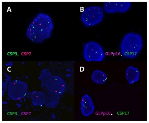 Figure 3 FISH. Chromosome 3 and p16 (rhodamine), chromosome 7 and 17 (FITC). (A and B) Example of the same urine specimen cell, in which the percentage of FISH signals are greater than the cut-off value (CSP3, 23%; CSP7, 21%; GLPp16, 7%; CSP17, 9%). (C and D) Example of the same urine specimen cell, in which the percentage of FISH signals are lower than the cut-off value (CSP3, 3%; CSP7, 2%; GLPp16, 4%; CSP17, 2%).