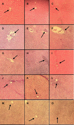 Figure 8 Photomicrographs of sections of liver tissues. (A–C at 6h, 12h and 24h) Control group. (D–F at 6h, 12h and 24h) LPS/D-GalN. (G–I at 6h, 12h and 24h) LPS/D-GalN + Ascorbic acid. (J–L at 6h, 12h and 24h) LPS/D-GalN + Silymarin. (M–O at 6h, 12h and 24h) LPS/D-GalN + p-CA100mg/kg. Arrow heads indicate the blood congestion in central vein in the hepatic lobule and accumulation of polymorphonuclear cells at the site of inflammation in the liver tissues.