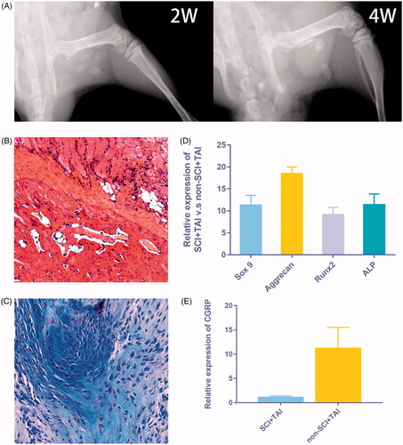 Figure 1. Elevated level of CGRP was observed in HO following spinal cord injury. (A) The X ray imaging demonstrated the formation of callus 2 and 4 weeks after modelling. (B,C) The H&E and Alcian Blue staining showed the formation of cartilage and bone-like tissues. (D) The chondrogenic and osteogenic genes also elevated significantly at day 14. (E) An increased level of CGRP was observed in muscle samples at 14 days after modelling.