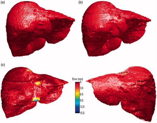 Figure 5. 3D visualization of ground truth and our proposed method. (a) Ground truth. (b) Our segmentation. (c) Error image.