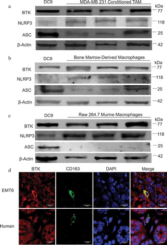 Figure 1. Human and murine macrophages express BTK and the NLRP3 inflammasome. (a) Immunoblot for BTK, NLRP3, ASC, and beta-actin (control) expression in TAM generated in vitro. (b) Immunoblot for BTK, NLRP3, ASC, and beta-actin expression in bone marrow-derived macrophages (c) Immunoblot for BTK, NLRP3, ASC, and beta- actin expression in the murine macrophage cell line RAW 264.7. Results are representative of three separate immunoblots in A- C and each lane represents a separate aliquot of cells. (d) Immunofluorescence staining of BTK and CD163 (macrophage marker) in EMT6 murine and human breast tumors. Human breast tumor is from a patient with invasive lobular carcinoma that was positive for estrogen and progesterone receptors and negative for HER 2/neu.