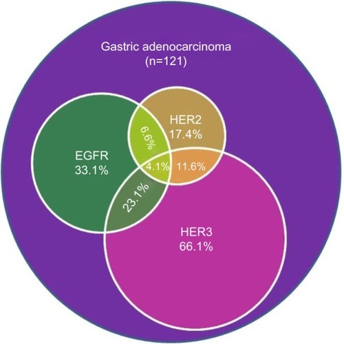 Figure 4 An illustration of the coexpression of HER family members in gastric adenocarcinoma.
