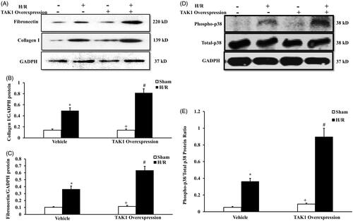 Figure 6. Upregulation of TAK1 aggravates collagen I and fibronectin expression and p38 phosphorylation of renal tubular epithelial cells with H/R treatment. (A) Representative western blots show collagen I and fibronectin protein levels in the renal tubular epithelial cells of mice with H/R or sham treatment after TAK1 overexpression plasmid or vehicle transfection. (B) Quantitative analysis of collagen I protein levels in the renal tubular epithelial cells. *p < .05 versus vehicle sham; +p < .05 versus TAK1 overexpression H/R; #p < 05 versus vehicle H/R, n = 4 each. (C) Quantitative analysis of fibronectin protein levels in the renal tubular epithelial cells. *p < .05 versus vehicle sham; +p < .05 versus TAK1 overexpression H/R; #p < .05 versus vehicle H/R, n = 4 each. (D) Representative western blots show phosphorylation levels of p38 in the renal tubular epithelial cells of mice with H/R or sham treatment after TAK1 overexpression plasmid or vehicle transfection. (E) Quantitative analysis of phosphorylation levels of p38 in the renal tubular epithelial cells. *p < .05 versus vehicle sham; +p < .05 vs. TAK1 overexpression H/R; #p < .05 versus vehicle H/R, n = 4 each.