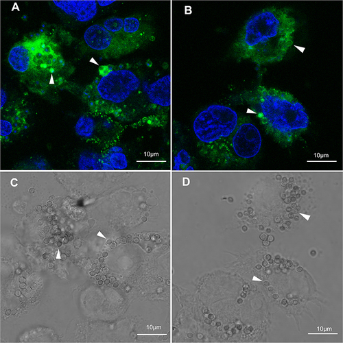 Figure 4 CD86 indirect immunofluorescence assay of THP-1 (CON group) cells co-cultured with T. marneffei conidia by confocal microscopy. (A and B) The nucleus of THP-1 cells and T. marneffei conidia were counterstained with DAPI (blue). T. marneffei conidia were highlighted by green fluorescence, which appeared as signet ring-like cells or inclusion body-like cells. (C) The image of A observed under bright field. (D) The image of B observed under bright field. The white arrow showed T. marneffei conidia as the same as appeared in images of A and B, respectively (original magnification: ×1000).