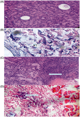 Figure 5. Histopathology of the injection site epidermis 48 h after SC injection of the BFSE (at ≈800 ng/rat). (a, b) Representative tissue samples from control rats showing normal architecture of epidermis with no sign of inflammation, necrosis, or congestion. (c, d) Representative tissue samples from treated rats showing acute, multifocal dermal necrosis, and deposition of fibrin (arrow) (H&E, 100×[a and c] and 1000× [b and d]).