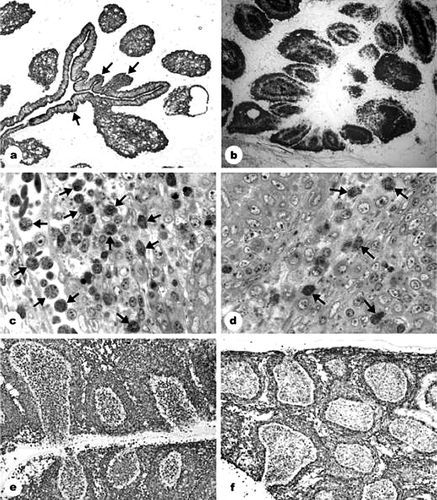 Figure 1.  Reactions to IBDV infection in 5-FU-pretreated and non-pretreated chickens. 1a: 5-FU and IBDV inoculation (group 3): 3 days after IBDV inoculation (p.i.), folded surface epithelium was observed (arrows); the medullary epithelial reticular cells form “empty holes”. Anticytokeratin immunostaining. Magnification, 40×. 1b: IBDV inoculation (group 2): 2 days p.i., B-cell depletion. Depletion started in the centre of the medulla and inner part of the cortex. Bu-1b staining. Magnification, 35×. 1c: IBDV inoculation (group 2): 2 days p.i., the follicular cortex flooded by heterophil granulocytes (arrows). Semithin section stained with toluidin blue. Magnification, 500×. 1d: 5-FU and IBDV inoculation (group 3): 2 days p.i., reduction in the number of heterophil granulocytes (arrows). Compare with 1c. Semithin section stained with toluidin blue. Magnification, 500×. 1e: IBDV inoculation (group 2): 2 days p.i., huge numbers of vimentin-positive cells in the medulla and surface epithelium of the follicles. Magnification, 140×. 1f: 5-FU and IBDV inoculation (group 3): 2 days p.i., the number of vimentin-positive cells in the medulla reduced as compared with group 2 (see 1e). Magnification, 140×.