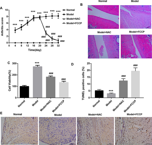 Figure 7 Oxidative stress promoted the pathogenesis of RA by inhibiting mitochondrial autophagy. SD rats were randomly divided into 4 groups: Normal control group, AA model group, NAC treatment group, and FCCP treatment group. (A) Arthritis index was calculated; (B) H&E staining was used to evaluate the pathology of synovial tissue, scale bar=200µm. (C) Synovial cells were isolated and cell viability was detected by CCK8. (D and E) TUNEL was used to detect the percentage of apoptosis of synovial cells in synovial tissue, scale bar=100µm. ***P < 0.001 vs Normal group, ###p < 0.001 vs model group.