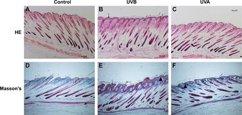 Figure 2 H&E and Masson’s staining (4x). Skin changes in histology. There was no statistical difference in epidermis between the control group and the UVA group (A, D, C and F). In the UVB group, the epidermis was significantly increased (B and E, ↓). There were large amounts of exfoliated epidermis in the UVB group (E, ←), and it was easy to see the hyperplastic sebaceous glands (E, ←). In the UV irradiation group, the collagen in dermis was disordered and the degradation was increased (E and F, ▲).