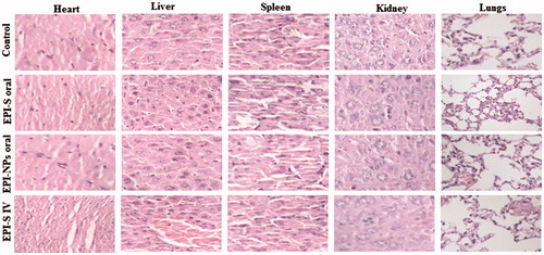 Figure 4. Histological analyzes of heart, liver, kidney, lungs and spleen of Ehrlich Ascites-induced tumor bearing balb/c mice, after treatment with; (a) oral PBS; (b) oral EPI-S; (c) Oral EPI-NPs; (d) EPI-S intravenous.