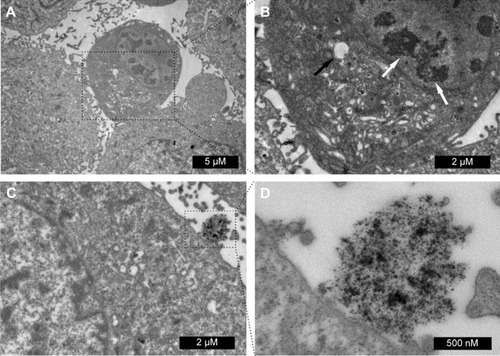 Figure 3 TEM investigation of FA-DOX@IONP-mediated cell apoptosis. (A, B) Intranuclear distorted chromatin clumps are denoted by white arrows and lipid droplet by black arrow. (C, D) FA-DOX@IONPs and breast cancer cell interaction.Abbreviations: DOX, doxorubicin; TEM, transmission electron microscopy; FA, folic acid; IONP, iron oxide nanoparticle.