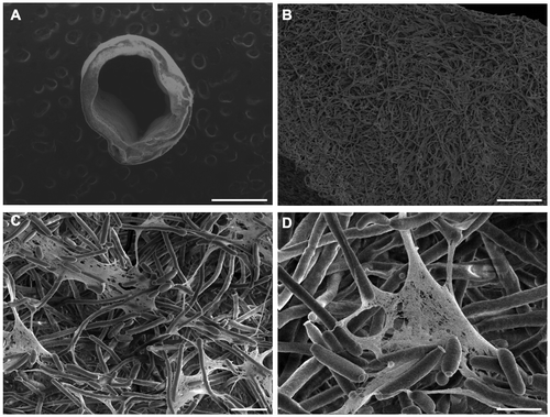 Figure 3. SEM images of C. albicans biofilms formed inside catheters. (A) 63× magnification with 30 kV and scale bar = 1 mm. (B) 1,000× magnification, 5 kV, scale bar = 50 μm. (C) 4,000× magnification, 5 kV, scale bar = 10 μm. (D) 10,000× magnification, 5 kV, scale bar = 5 μm.
