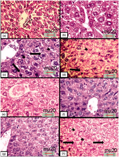 Figure 2. Haematoxylin and eosin-stained liver sections: (a) and (b) control mice at days 22 and 37, respectively, showing normal hepatic architecture; (c) and (d) mice that were injected with 200 mg/kg CTX at days 22 and 37, respectively, showing vacuolar-degenerated hepatocytes with piknotic nuclei (arrows). Also, notice the coagulative necrosis of many hepatocyte (arrowheads); (e) and (f) mice that were pretreated with 100 mg/kg MEROL before CTX injection at days 22 and 37, respectively, showing that hepatocytes has partial improvement at day 22 and regained its normal architecture at day 37; (g) and (h) mice that were pretreated with 200 mg/kg MEROL before CTX injection at days 22 and 37, respectively, showing partial improvement in the hepatic architecture at 22 d while showing a hepatic degeneration at day 37 representing in the detection sever centrilobular pattern of degeneration and necrosis (arrowheads) with wide vacuolar degeneration (arrows) (haematoxylin- and eosin-stained paraffin sections; H& E ×400).