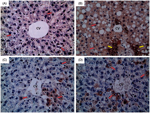 Figure 6. Photomicrographs of liver sections obtained from different groups (iNOS immunohistochemical stain; 400×), where (A) normal control group showing weak immunoreactivity to iNOS which appears as faint brown colour (red arrow); (B) ferrous sulphate group showing strong immunoreactivity to iNOS which appears as brown colour (red arrow) with some areas of intense immunoreactivity (yellow arrow); (C) N-acetylcysteine plus ferrous sulphate group showing mild immunoreactivity to iNOS which appears as brown colour (red arrow); (D) saponin plus ferrous sulphate group showing moderate immunoreactivity to iNOS which appears as brown colour (red arrow).