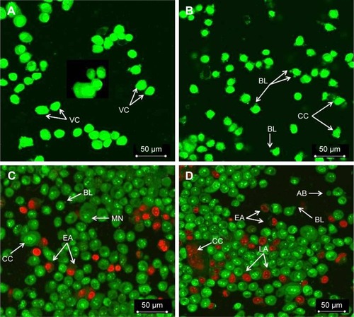 Figure 5 Confocal micrographs of AO and PI double-stained COLO205 cells. Cells were treated with IC50 of MGR in a time-dependent manner. (A) Untreated cells showed normal structure without prominent apoptosis and necrosis. (B) Early apoptosis features were seen after 24 hours representing intercalated AO (bright green) among the fragmented DNA. (C) BL and nuclear margination were noticeable after 48 hours of treatment (arrows). (D) Late apoptosis was seen after 72 hours of treatment (a positive staining of orange color represents the hallmark of late apoptosis).