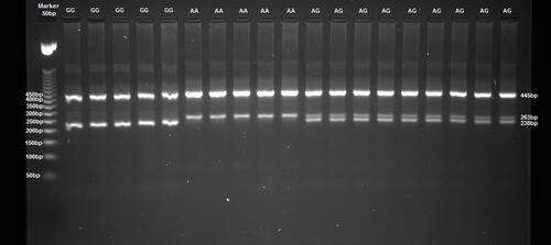 Figure 1 The rs10757278 genotyping for the G/A alleles using ARMS-PCR. Lane 1: 50 bp ladder. Lane 2–6: GG genotypes. Lane 7–11: AA genotypes. Lane 12–20: AG genotypes.