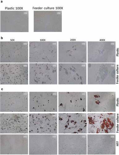 Figure 3. HFF feeder culture increases adipocyte formation. (a) Light microscopic images of ASCs in pure culture (left) and ASCs in co-culture with HFF feeder (right) are shown. (b) Adipocyte differentiation was induced by hormone cocktail and ASCs in pure culture on plastic dishes and co-culture with HFF feeder were imaged using a light microscope at d 14 post induction of differentiation to estimate the formation of lipid droplets. Representative images from three biological repeats are shown. (c) Accumulation of lipids at d 14 post differentiation was confirmed using Oil-Red-O staining. Representative images from three biological repeats are shown. (d) The number of Oil-Red-O positive cells formed in pure culture on plastic dishes and in feeder culture is indicated. Three biological repeats were employed. (e) The size of fat droplets in formed adipocytes in pure culture on plastic dishes and in feeder culture was measured using ImageJ software and plotted as arbitrary units. Cells from three donors were employed. (f) Oil-Red-O uptake by formed adipocytes in pure culture and feeder culture was quantified by eluting the stain in isopropanol and measuring the absorbance at 518 nm. Graphs are representative of two biological repeats. (g) Feeder culture leads to an enhanced adipogenic differentiation as depicted by whole well image after staining with Oil-Red-O. Images are representative of two biological repeats. (h) D 14 post induction of adipocyte differentiation in pure culture on plastic dishes and in combination with HFFs in feeder culture cells were fixed and stained with LipidTox (green) while nuclei are stained with DAPI (blue), 400× magnification. n = 3. (i) Insulin-stimulated glucose uptake in human ASCs grown on plastic and feeder layer. (Left panel) ASCs were cultured either directly on plastic or on feeder layer until d 14 post induction of differentiation. HFFs alone served as control. After incubation in insulin-free medium for 1 d, cells were stimulated with medium containing insulin. One hour later, 2-NBDG was added for 10 min. The reaction was stopped by washing with PBS, and 2-NBDG uptake was analysed by fluorescence microscopy. N = 3 donors; representative images from one donor are shown. (Right panel) Fluorescence was measured using ImageJ, the mean fluorescence from HFFs was subtracted as background. For quantification, five images per donor were used. All error bars represent the mean ± SEM. *p < 0.05, ** p < 0.001 and ***p < .0001. Analysis of variance (ANOVA) is applied for (F), while Student’s t-test is applied to (d), (e) and (i).