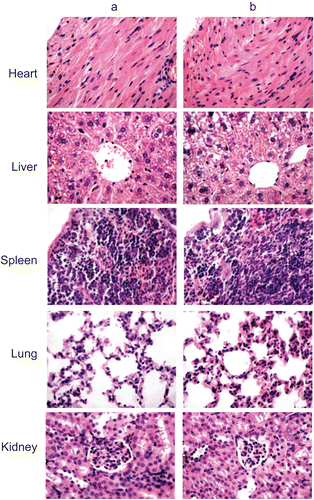 Figure 5.  Representative photomicrographs of the heart, liver, spleen, lung, and kidney sections (H&E staining) of mice of control group (a) and treated with test NPs (b).