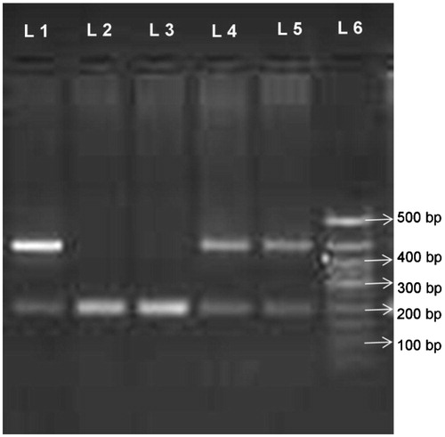 Figure 1. Representative photograph of ACE gene in HT patients with and without CKD. Lanes 1, 4, and 5: heterozygous ID samples (190 bp and 490 bp). Lanes 2 and 3: homozygous DD sample (190 bp). Lane 6: DNA ladder 50–500 bp (Hind III digest Ladder).