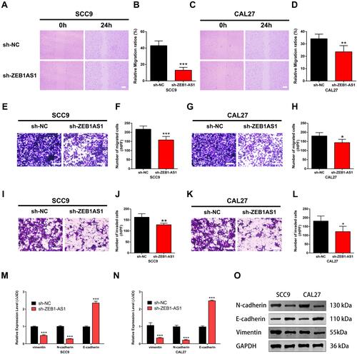 Figure 3 ZEB1-AS1 knockdown inhibited OSCC cell migration and invasion. (A–D) The cell migration distance following sh-ZEB1-AS1 transfection. (E–H) The number of migrated cells following sh-ZEB1-AS1 transfection. (I–L) The number of invaded cells following sh-ZEB1-AS1 transfection. (M, N) The expression of EMT-related genes vimentin, N-cadherin, and E-cadherin following sh-ZEB1-AS1 transfection in OSCC cell lines. (O) The protein levels of vimentin, N-cadherin, and E-cadherin following sh-ZEB1-AS1 transfection in OSCC cell lines. Data are presented as the means ± SD. *P < 0.05; **P < 0.001; ***P < 0.0001. Scale bar=50μm.