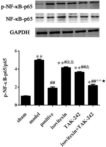 Figure 5. Level of p-NF-κB-p65. (A) Representative images of western blot analysis. (B) Relative protein expression levels of NF-κB. *p < 0.05 compared with the sham group, **p < 0.01 compared with the sham group; #p < 0.05 compared with the model group, ##p < 0.01 compared with the model group; &p < 0.05 compared with the positive group, &&p < 0.01 compared with the positive group; ^^p < 0.01 compared with the isovitexin group; ★p < 0.05 compared with the TAK-242 group.