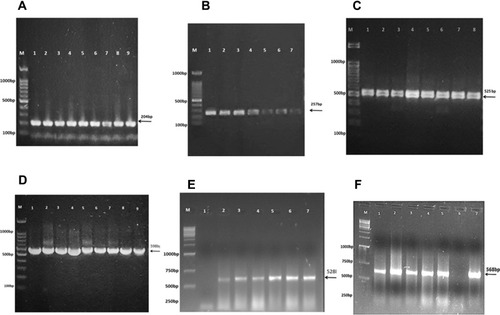 Figure 3 16S rRNA gene PCR-based identification bacteria isolated from CSF of bacterial meningitis patients. (A) E. coli isolates with 204bp amplified fragments; (B) S. aureus solates 257bp amplified fragments; (C) K. pneumoniae isolates 525bp amplified fragments; (D) S. pneumoniae isolates 598bp amplified fragments; (E) H. influenzae isolates 528bp amplified fragments; (F) N. meningitidis isolates 568bp amplified fragments. M= molecular weight marker (1kb).